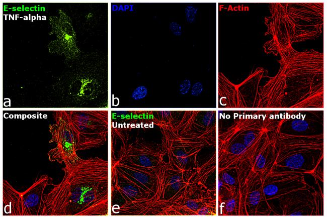 E-selectin Antibody in Immunocytochemistry (ICC/IF)