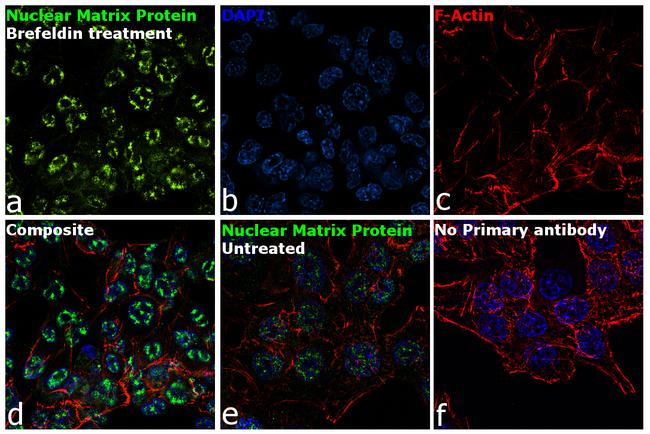 Nuclear Matrix Protein p84 Antibody in Immunocytochemistry (ICC/IF)