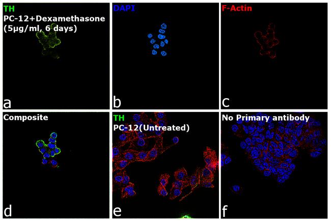 Tyrosine Hydroxylase Antibody in Immunocytochemistry (ICC/IF)