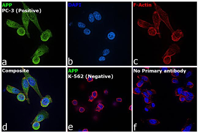 Amyloid Precursor Protein Antibody in Immunocytochemistry (ICC/IF)