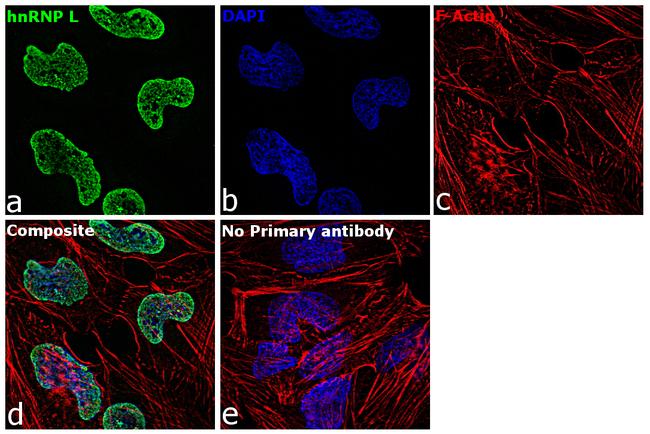 hnRNP L Antibody in Immunocytochemistry (ICC/IF)