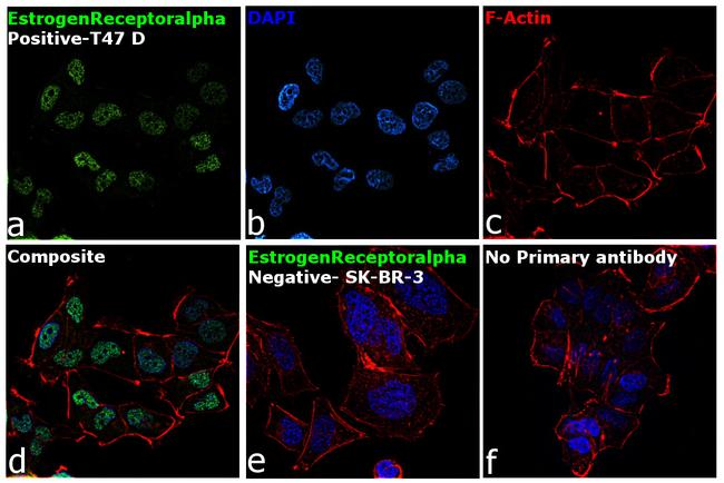 Estrogen Receptor alpha Antibody in Immunocytochemistry (ICC/IF)