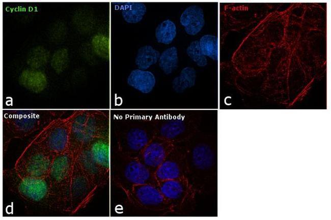 Cyclin D1 Antibody in Immunocytochemistry (ICC/IF)