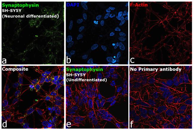 Synaptophysin Antibody in Immunocytochemistry (ICC/IF)