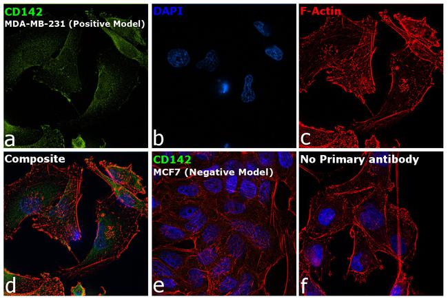 CD142 Antibody in Immunocytochemistry (ICC/IF)