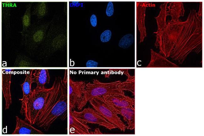 THRA Antibody in Immunocytochemistry (ICC/IF)