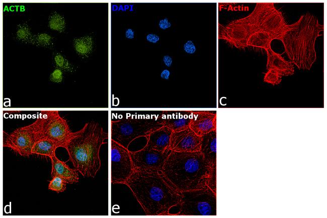 Actin Antibody in Immunocytochemistry (ICC/IF)