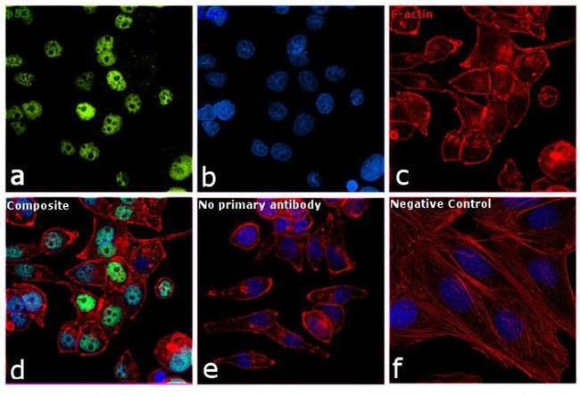 p53 Antibody in Immunocytochemistry (ICC/IF)