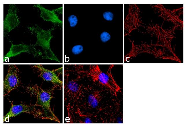 TIMP1 Antibody in Immunocytochemistry (ICC/IF)