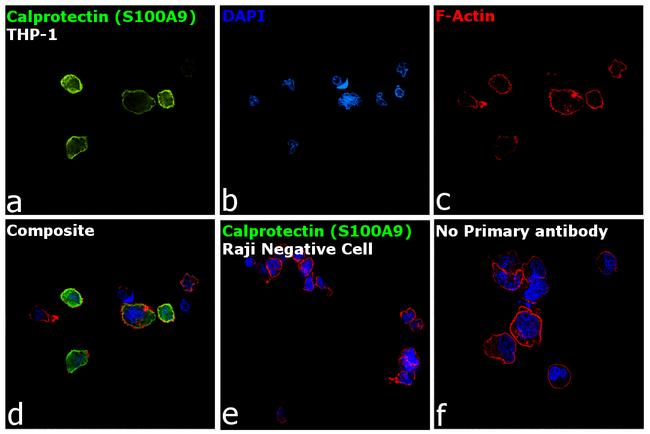 Calprotectin Antibody in Immunocytochemistry (ICC/IF)