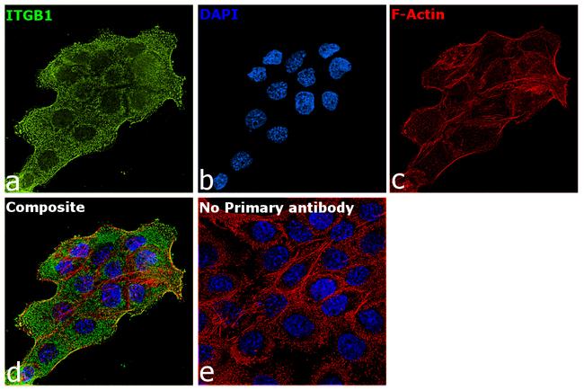 ITGB1 Antibody in Immunocytochemistry (ICC/IF)