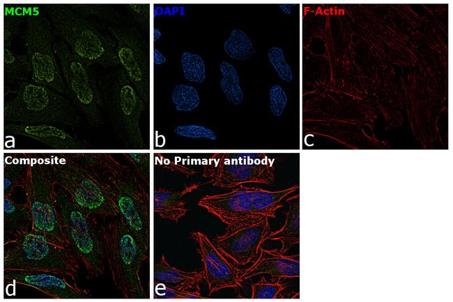 MCM5 Antibody in Immunocytochemistry (ICC/IF)