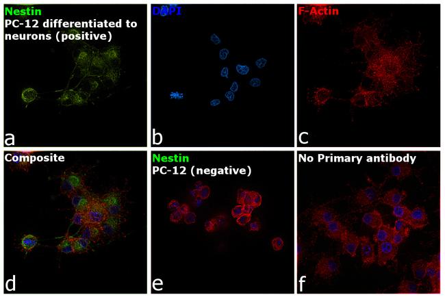 Nestin Antibody in Immunocytochemistry (ICC/IF)