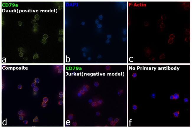 CD79a Antibody in Immunocytochemistry (ICC/IF)