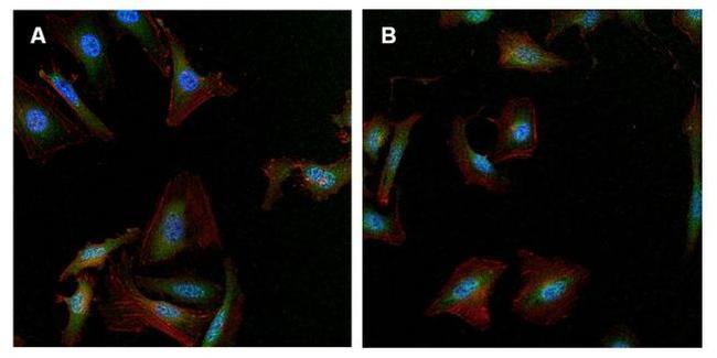 gamma Tubulin Antibody in Immunocytochemistry (ICC/IF)