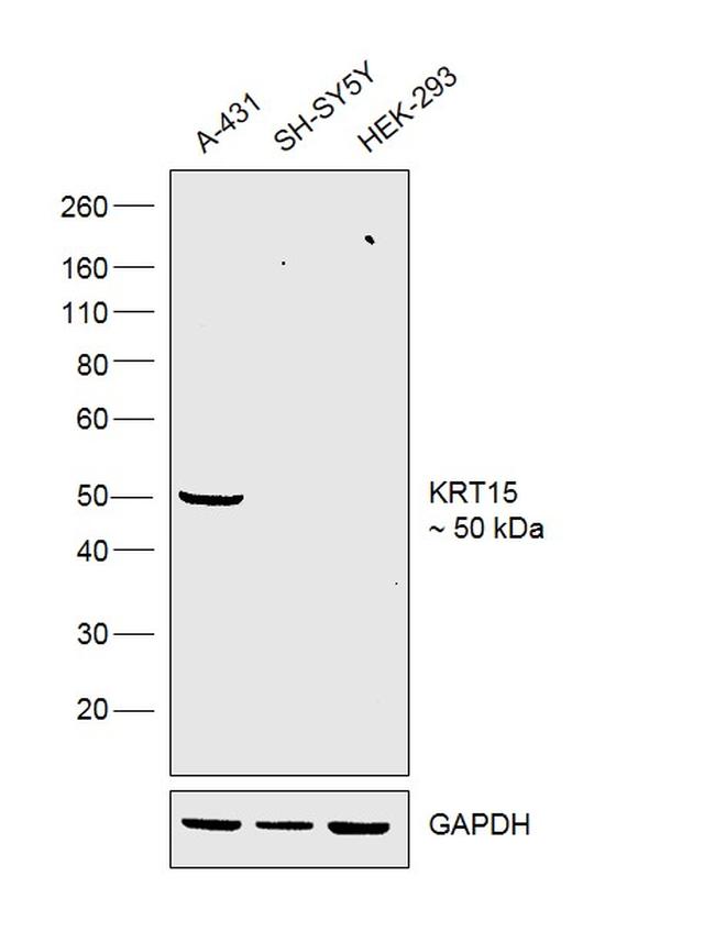 Cytokeratin 15 Antibody in Western Blot (WB)