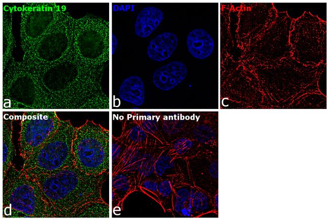 Cytokeratin 19 Antibody in Immunocytochemistry (ICC/IF)