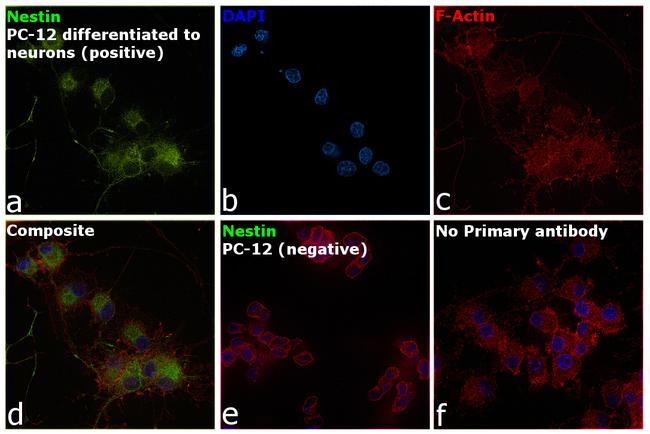 Nestin Antibody in Immunocytochemistry (ICC/IF)