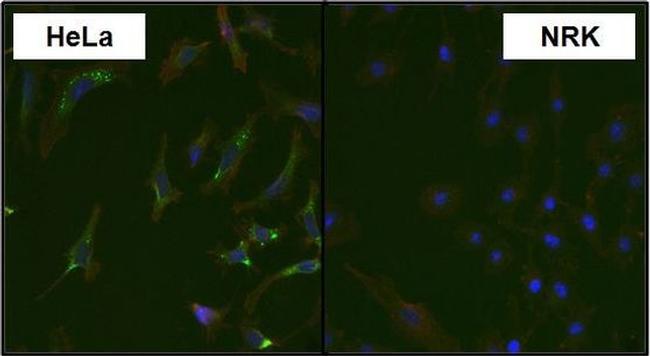 MAP2K4 Antibody in Immunocytochemistry (ICC/IF)