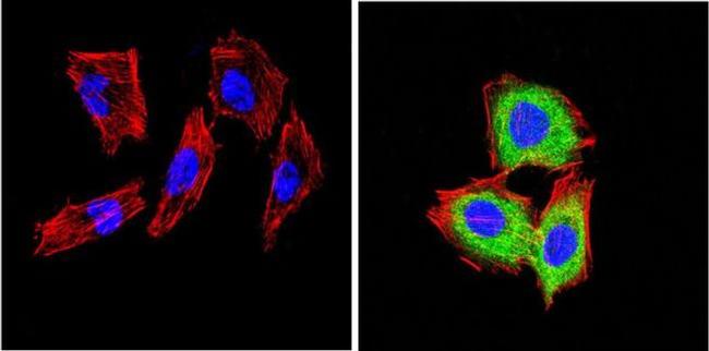 CD26 Antibody in Immunocytochemistry (ICC/IF)