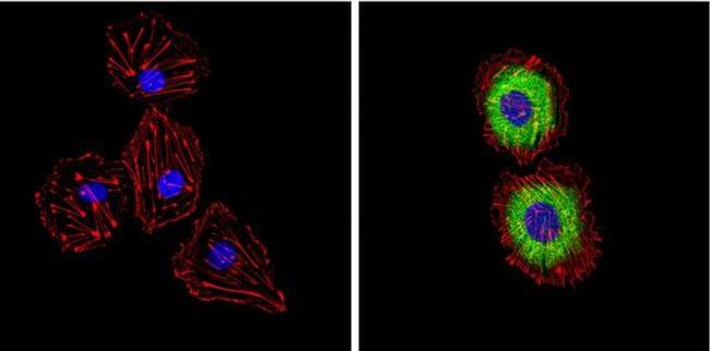 Endothelin 1 Antibody in Immunocytochemistry (ICC/IF)