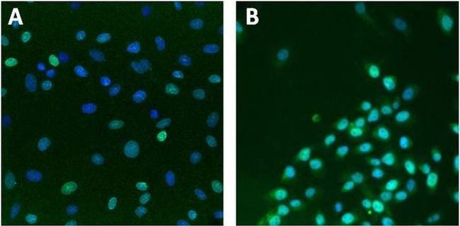 Lamin A/C Antibody in Immunocytochemistry (ICC/IF)