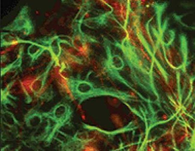 alpha Internexin Antibody in Immunocytochemistry (ICC/IF)