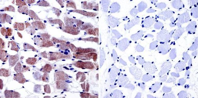 CaV1.1 Antibody in Immunohistochemistry (Paraffin) (IHC (P))