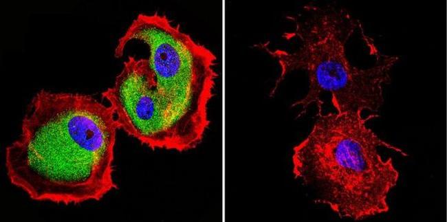 Mu-Calpain Antibody in Immunocytochemistry (ICC/IF)