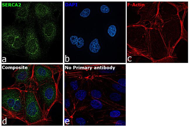 SERCA2 ATPase Antibody in Immunocytochemistry (ICC/IF)