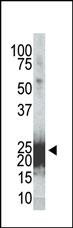 Phospho-BAD (Ser155) Antibody in Western Blot (WB)