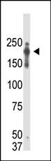 PRDM2 Antibody in Western Blot (WB)