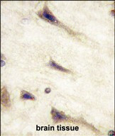 EphA5 Antibody in Immunohistochemistry (Paraffin) (IHC (P))