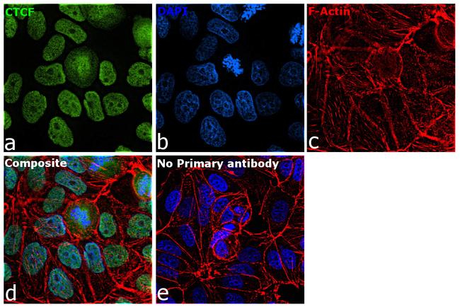 CTCF Antibody in Immunocytochemistry (ICC/IF)