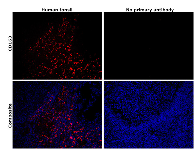 CD163 Antibody in Immunohistochemistry (Paraffin) (IHC (P))