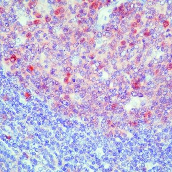 Caspase 3 Antibody in Immunohistochemistry (Paraffin) (IHC (P))