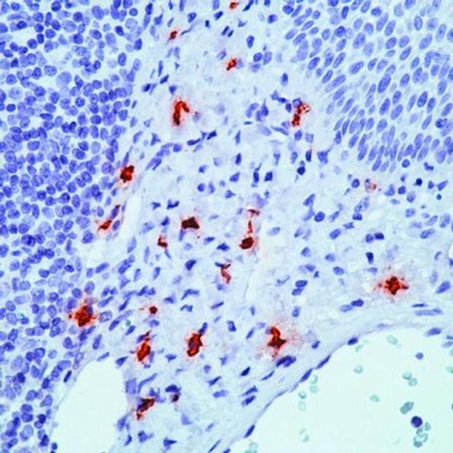 Tryptase Antibody in Immunohistochemistry (Paraffin) (IHC (P))