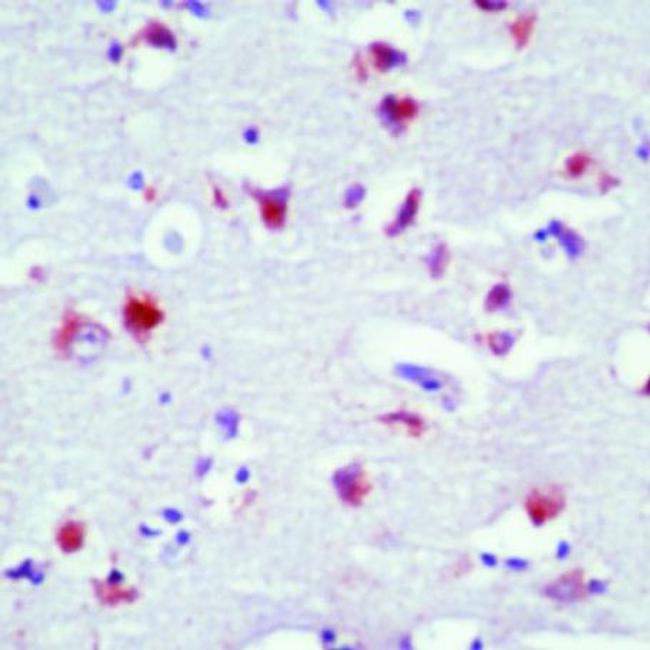 Rhodopsin Antibody in Immunohistochemistry (Paraffin) (IHC (P))