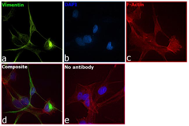 Vimentin Antibody in Immunocytochemistry (ICC/IF)