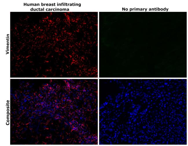 Vimentin Antibody in Immunohistochemistry (Paraffin) (IHC (P))