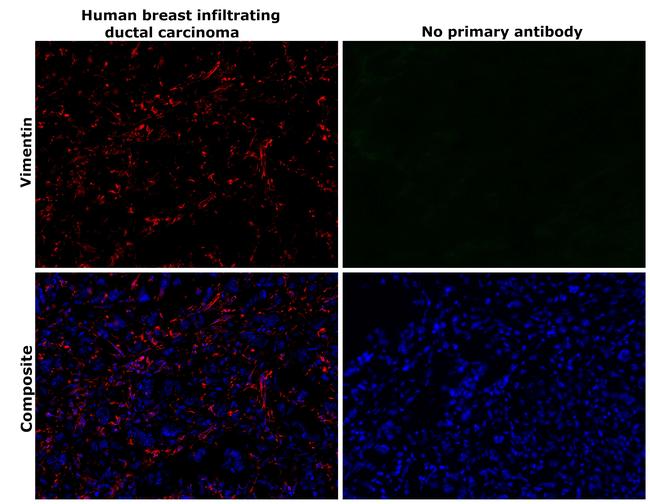 Vimentin Antibody in Immunohistochemistry (Paraffin) (IHC (P))