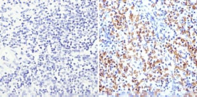 CD235a Antibody in Immunohistochemistry (Paraffin) (IHC (P))