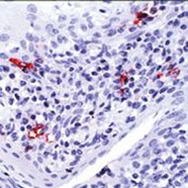 CD1a Antibody in Immunohistochemistry (Paraffin) (IHC (P))