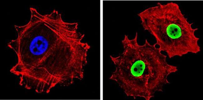 Ku70/Ku80 Antibody in Immunocytochemistry (ICC/IF)