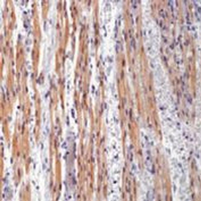 Cardiac Troponin T Antibody in Immunohistochemistry (Paraffin) (IHC (P))