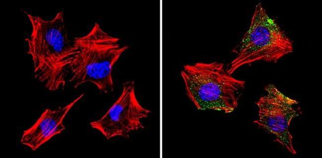 S100 Antibody in Immunocytochemistry (ICC/IF)