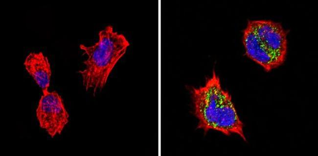 Chromogranin A Antibody in Immunocytochemistry (ICC/IF)