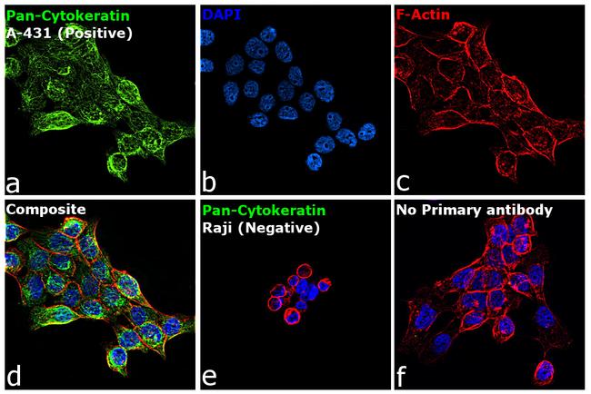 Cytokeratin Pan Antibody in Immunocytochemistry (ICC/IF)