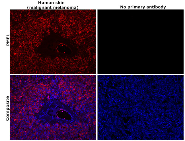 PMEL Antibody in Immunohistochemistry (Paraffin) (IHC (P))