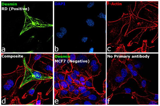 Desmin Antibody in Immunocytochemistry (ICC/IF)